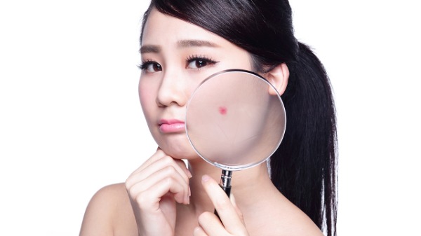 夏天臉上長痘痘咋辦 這份戰(zhàn)“痘”秘訣請查收