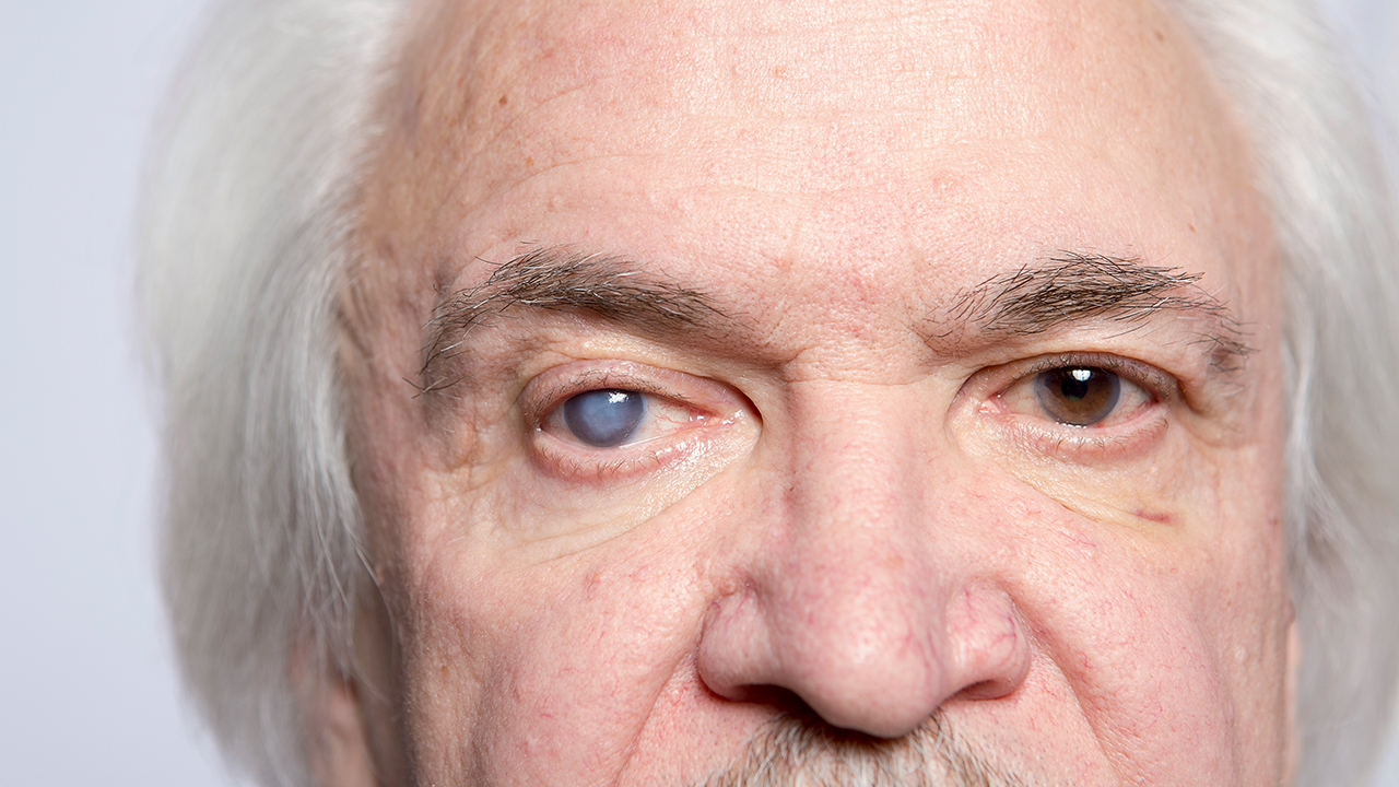 雙眼皮為什么變成內(nèi)雙？為什么別人的雙眼皮比看？