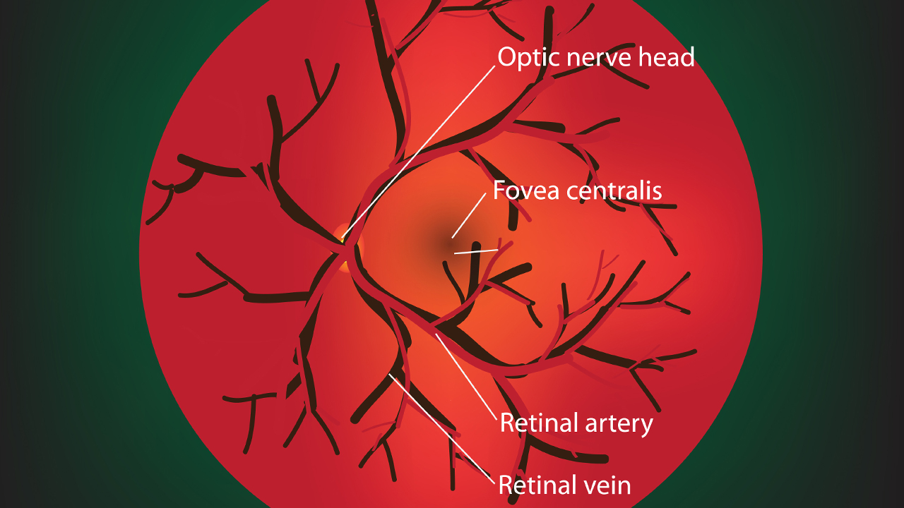 怎樣判斷孩子是不是內(nèi)斜視