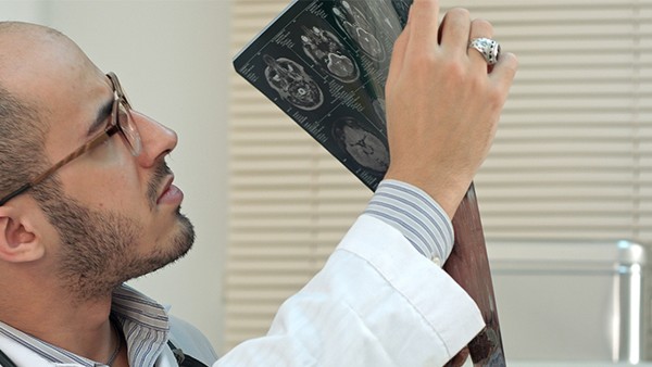 腦出血30ml還能痊愈嗎