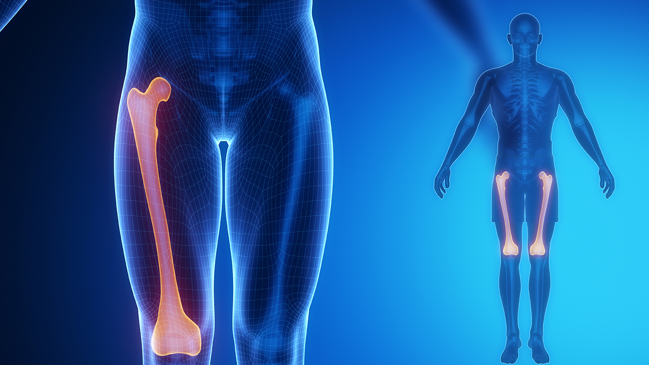頸椎間盤突出比骨折輕松嗎