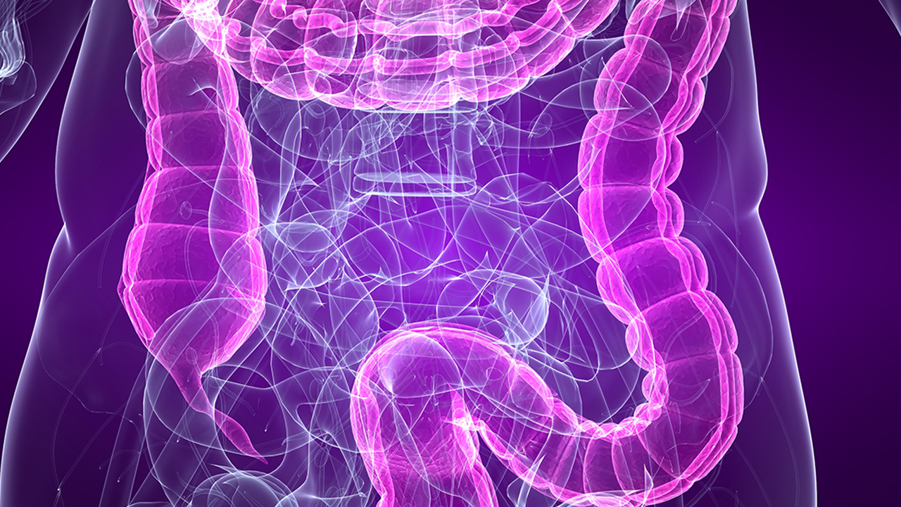 從腸息肉到結(jié)腸癌需要幾年