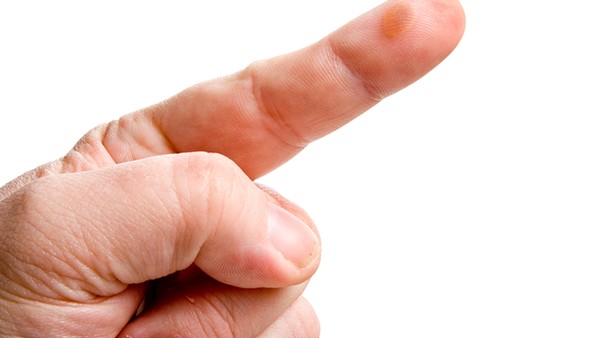 燙傷后的紅色疤痕怎么去除