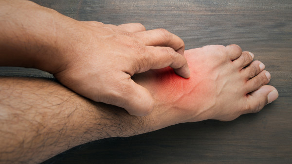 帶狀皰疹是鏈球菌感染嗎