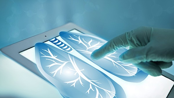 肺癌出現(xiàn)腔結(jié)核可以手術嗎