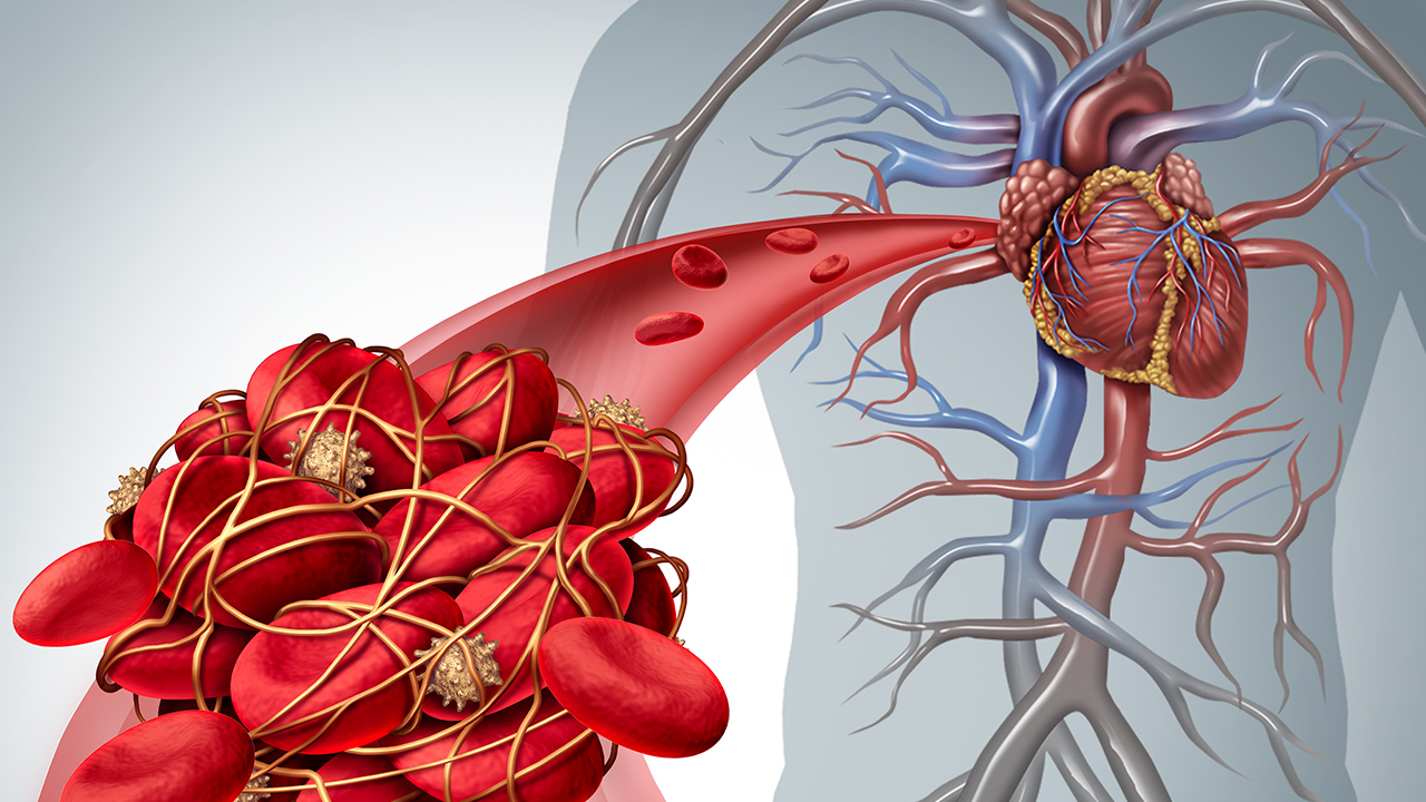 被診斷為高血壓應(yīng)如何用藥，注意什么？