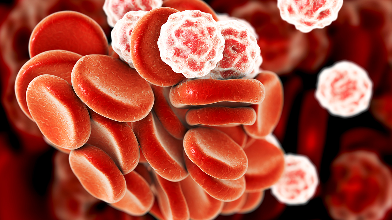 白細(xì)胞減少是白血病的癥狀嗎