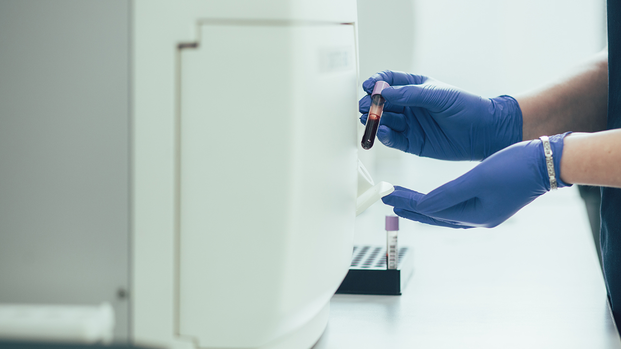 怎么篩查淋巴癌早期