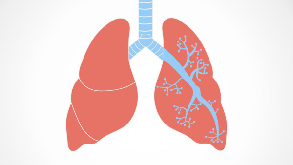咳血痰是肺結(jié)核引起的嗎