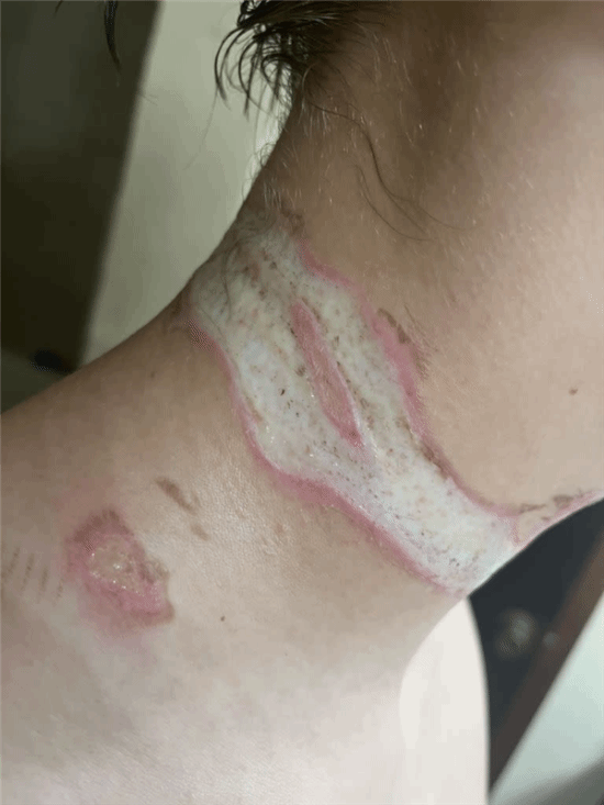 手機(jī)充電意外觸電：小伙差點(diǎn)被金屬十字架項(xiàng)鏈烤熟