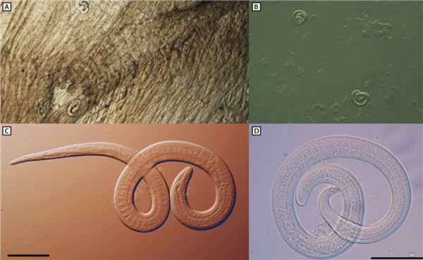 吃了未熟透的熊肉：美國(guó)一家6口全部感染致命旋毛蟲(chóng)病