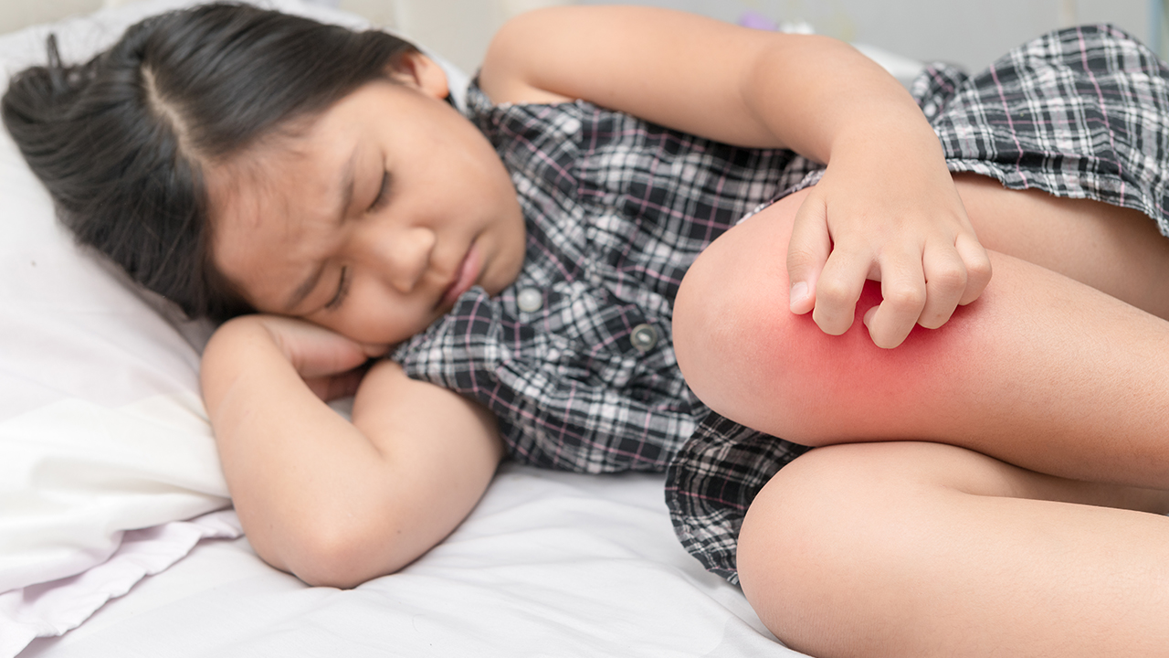 血檢哪項是查類風(fēng)濕