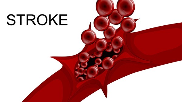 低鉀會(huì)不會(huì)變尿毒癥