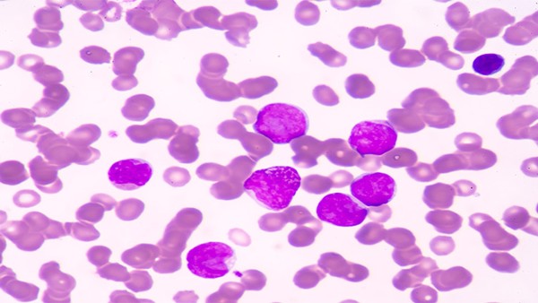 經(jīng)常抓頭皮會得皮膚癌嗎