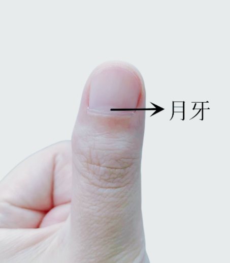 指甲出現(xiàn)一條黑線 別不當(dāng)回事！可能是癌變