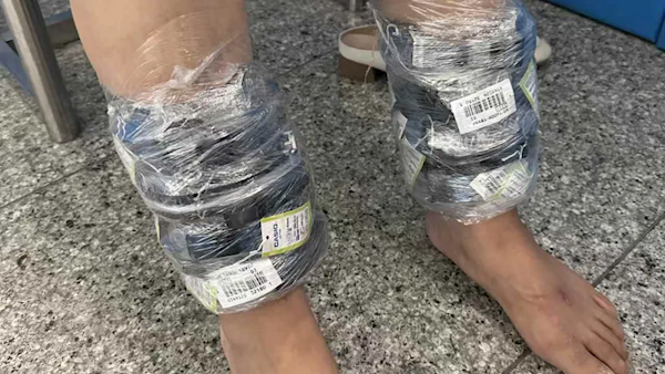 女子小腿綁40塊卡西歐手表進境 結(jié)果因步態(tài)僵硬被查獲