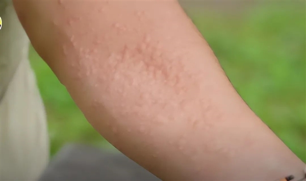 長滿毛刺還有毒的蕁麻：一小哥愣是30分鐘生吃35米