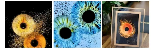 許多情侶開始給眼珠拍寫真 醫(yī)生緊急提醒