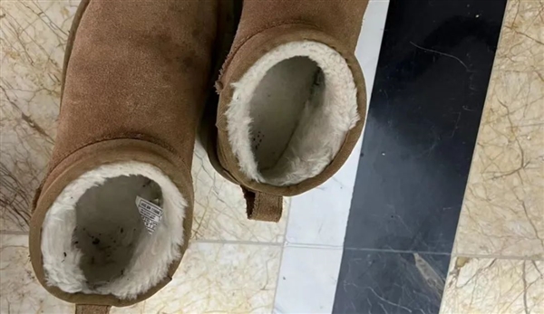 雪地靴又上熱搜！經(jīng)常穿真的很傷腳 醫(yī)生緊急提醒