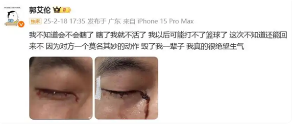 陶勇醫(yī)生談郭艾倫眼睛縫40多針：可以恢復(fù)的很好 不會影響運動生涯