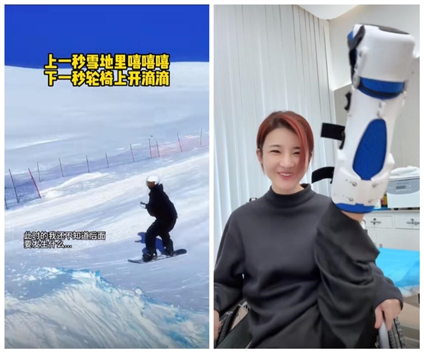 500萬粉網(wǎng)紅滑雪摔骨折：打24顆釘子